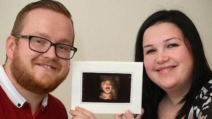 Uniknya Janin Ini Tersenyum Dalam Perut Sang Bunda