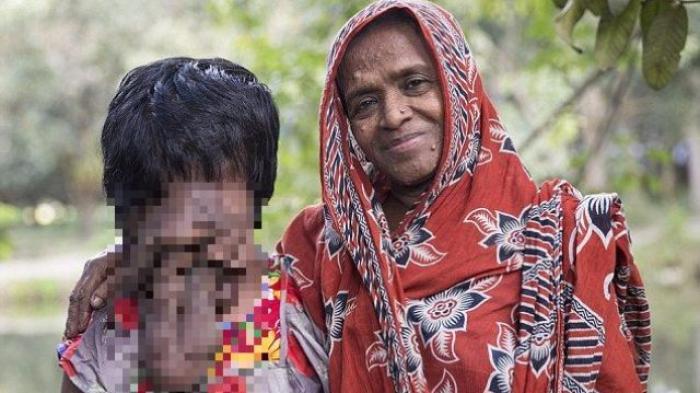 Help Khadija. Beratnya Cobaan Gadis India Berwajah Mirip Belalai - khadija_20151107_113944.jpg