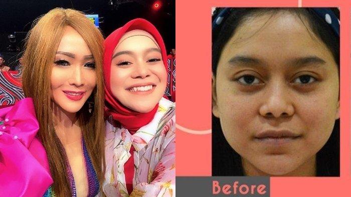 Wajah Lesty Kejora Dinyinyiri, Pembelaan Inul Daratista : Biyen Elek Saiki Ayu Iku Sah