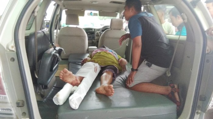 Luka Parah, Korban Tabrakan Bus Damri Meninggal Dunia