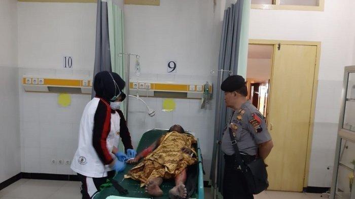 Perempuan Ini Siram Tubuhnya Dengan Bensin Lalu Sulut dengan Api, Begini Kondisinya Sekarang