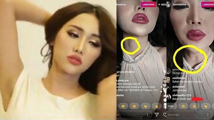 Bagian Tubuh Sensitif Ini Membuat Netizen Ragukan Keaslian Kewanitaan Lucinta Luna