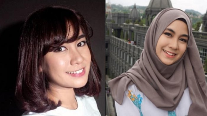 Jarang Muncul di TV Usai Hengkang dari Cherrybelle, Ini Perubahan Mengejutkan Anisa Chibi