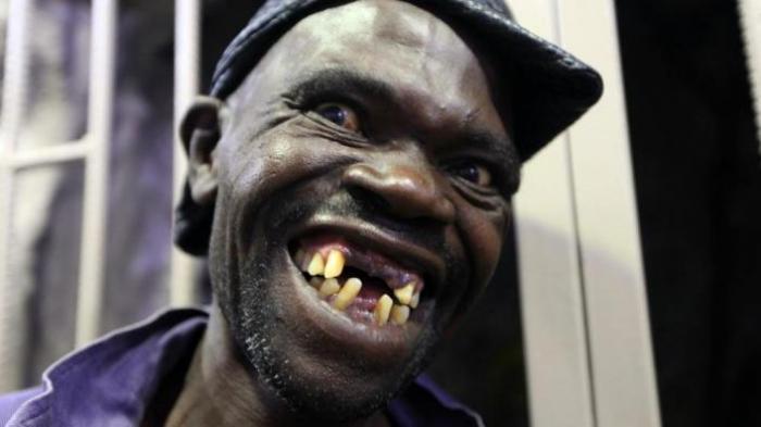 Wajah Jelek Pria Ini Mengantarnya Menjadi Mister Ugly di Zimbabwe