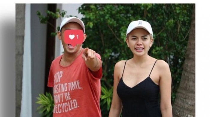 Wow! Nikita Mirzani Nekat Rogoh Ratusan Juta untuk Operasi Miss V Demi Lelaki Ini