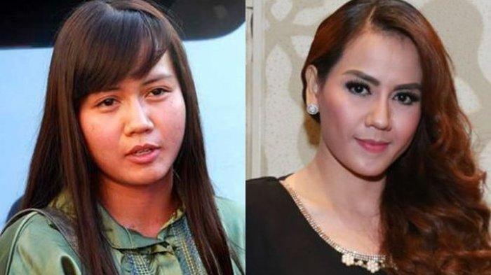 Nita Thalia Murka Usai Nurdin Ruditia Sebut Alasan Cerai Lantaran Tak Kuat Biayai Kecantikannya