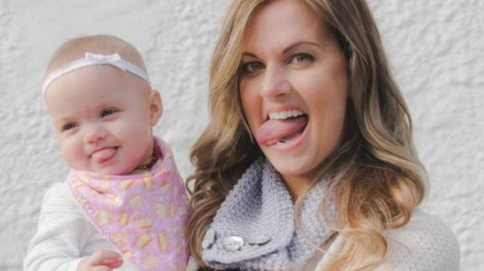 Mengidap Kelainan Bawaan, Lidah Bayi ini Selalu Terjulur Setiap Saat