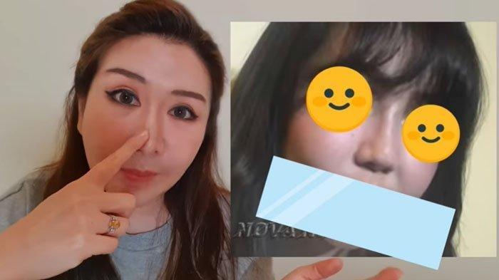 Nama Via Vallen Terseret, Tompi Semprot Olivia Rachelina yang Bahas Soal Operasi Plastik