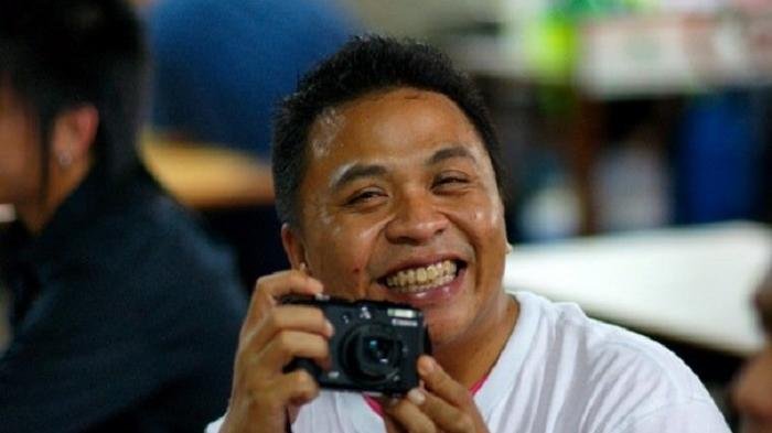 Waduh! Oon Project Pop Sempat Naik Motor dengan Kaki Terbalut dan Agak Limbung