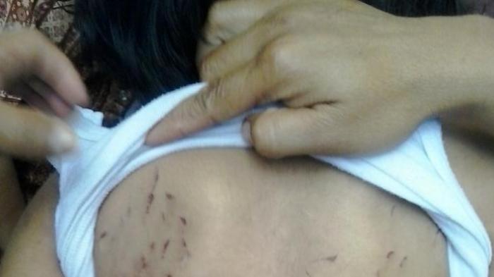 Malang Bagi Bocah Ini, Ia Disiksa Sejak TK