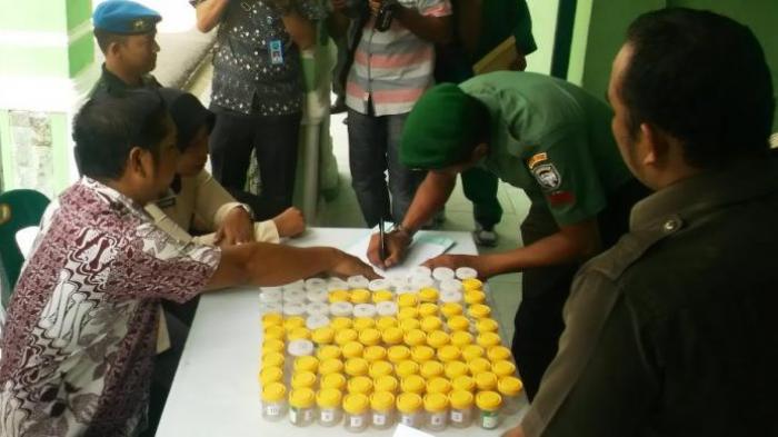 Tes Urine dan Darah Banyak kelemahan, IDI dan BNN Usulkan Tes Rambut