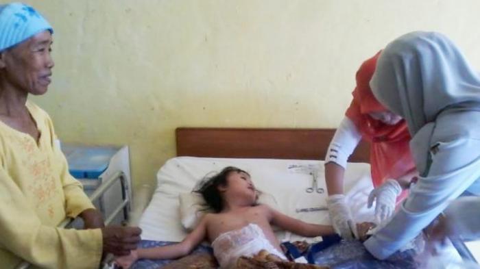 Berusia 16 Tahun, Rini Novita Memiliki Tubuh seperti Anak Balita