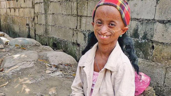 Penampilan Gadis 18 Tahun Ini Seperti Wanita Lanjut Usia