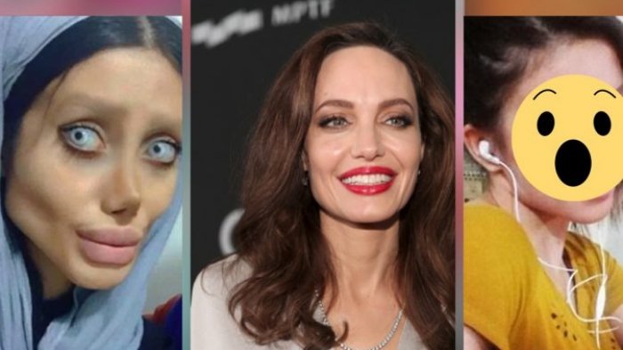 Sahar Tahar, Remaja Iran yang Operasi Plastik Mirip Angelina Jolie ini Bantah Telah Operasi 50 Kali