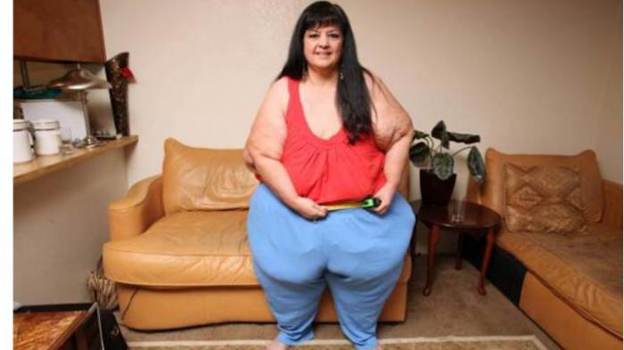 Tiap Hari Konsumsi 13 Ribu Kalori, Bobot Tubuh Wanita Ini Melambung 330 Kilogram