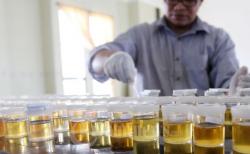 Urine Semua Sopir Bakal Diperiksa