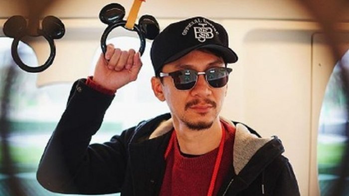 Aksi Vincent Rompies Bikin Guyonan Operasi Plastik di Acara TV, Sindir Ratna Sarumpaet?