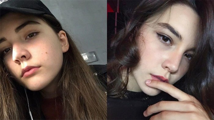 Mirisnya Nasib Model Ini! Berharap Punya Masa Depan Cerah saat Muda, Malah Bernasib Tragis