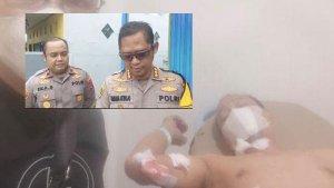 Caleg-PKS-di-Banjarmasin-menjalani-perawatan-usai.jpg