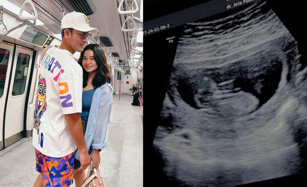 Perubahan Besar Olivia Allan Semenjak Berbadan Dua, Denny Sumargo Berani Bayar Mahal