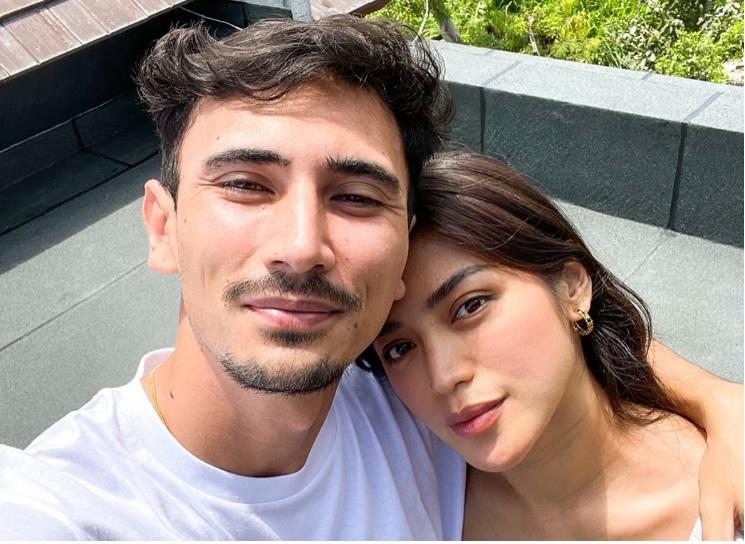 Jessica Iskandar Akhirnya Buka Kartu, Istri Vincent Verhaag Ungkap Biaya Oplas di Korea : Endorse