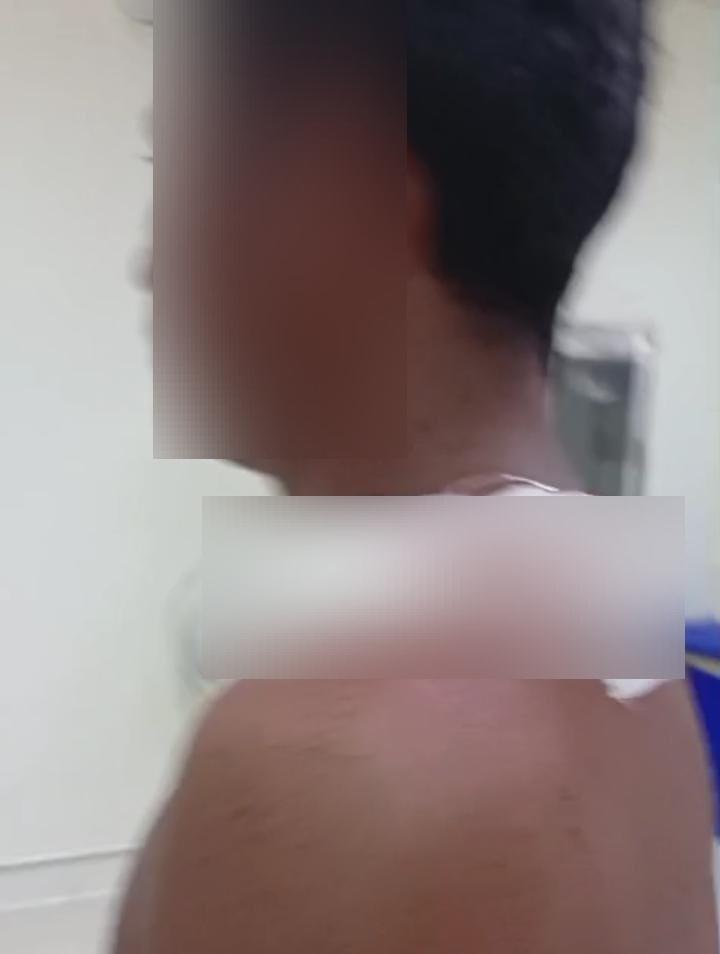 Polres Tanahlaut Buru Pelaku Penganiayaan di Gunungraja, Diduga Duel Saudara Sepupu