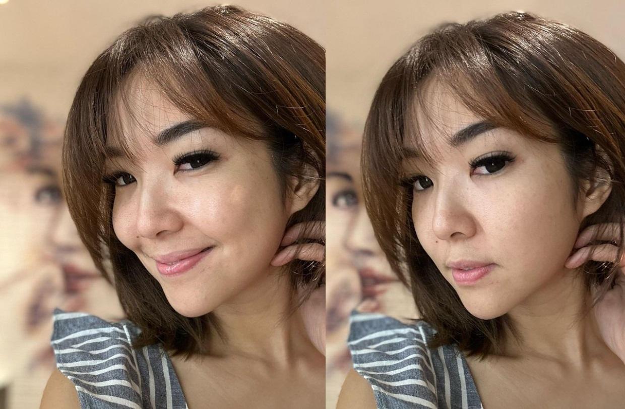 Nyaris Rawat Inap, Gisel Beber Penyakit yang Kini Diidap: Ada Penebalan