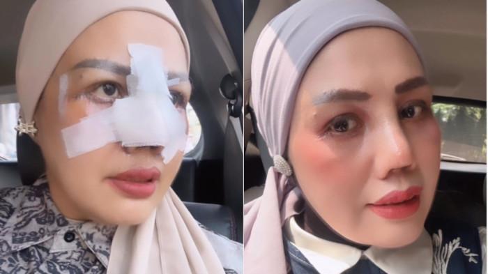Rombak Wajahnya di Indonesia, Elly Sugigi Beber Biaya Operasi Plastik Bagian Mukanya: Kan Barter - Banjarmasinpost.co.id
