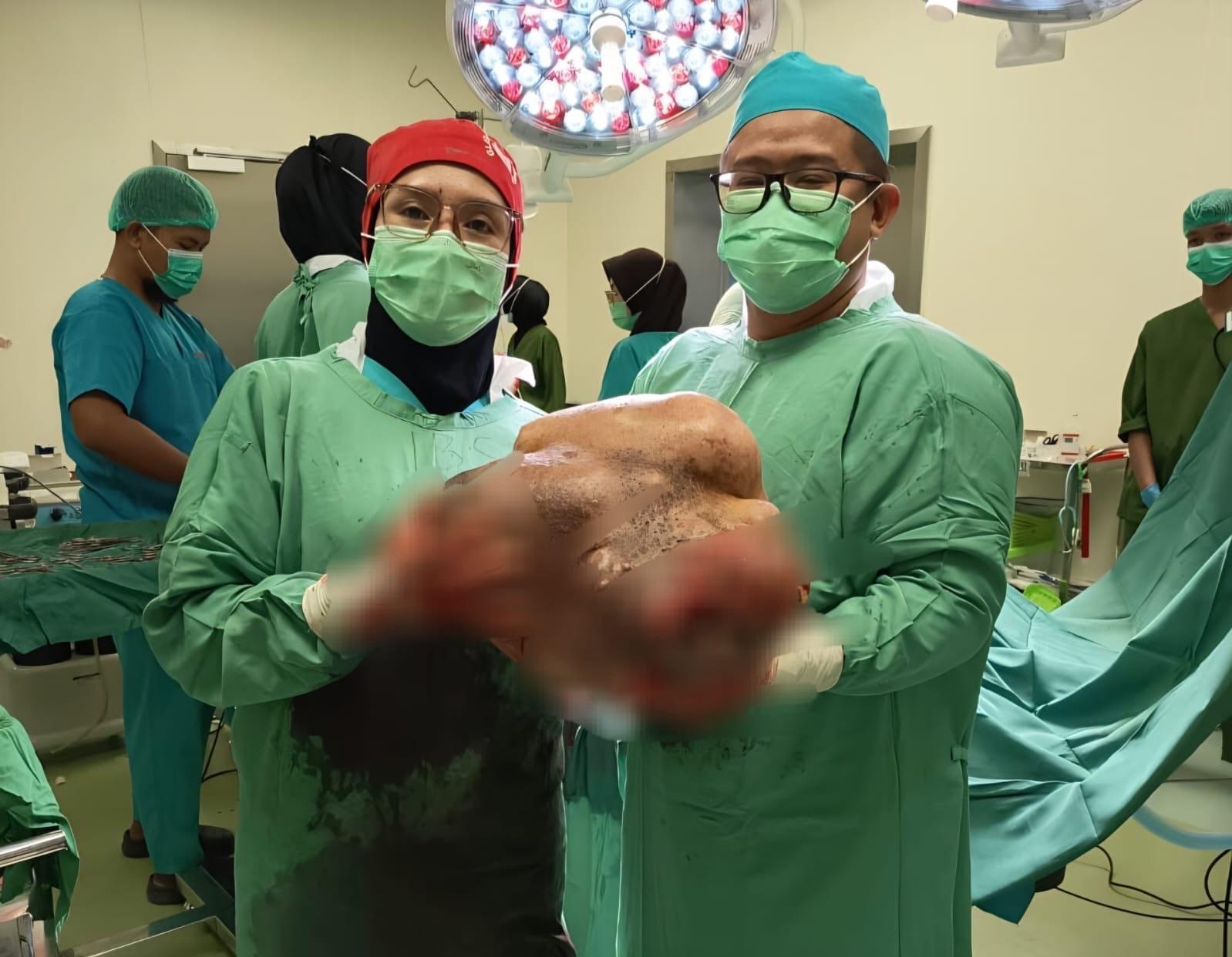 Tumor-seberar-136-kikogram-yang-sebelumnya-bersarang-di-tubuh-seorang-ibu-di-Banjarbaru.jpg