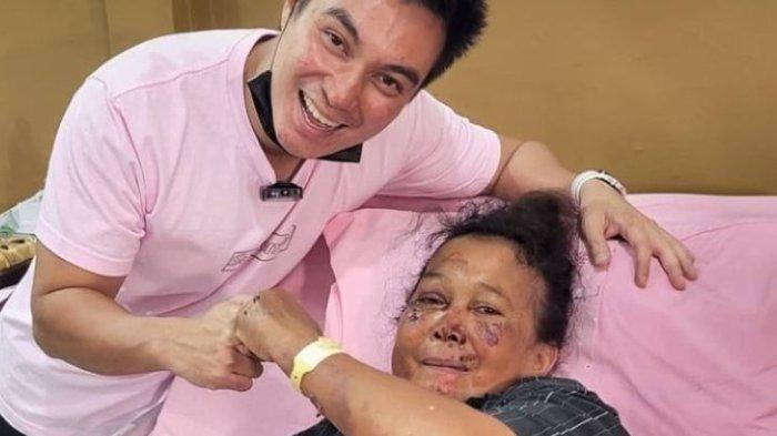 baim-wong-jenguk-wanitakorban-perampokan.jpg