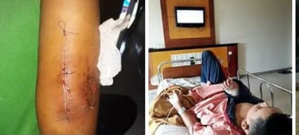 Disebut Tak Bertanggungjawab Terhadap Atlet Persetala Cedera, ini Tanggapan Dispora