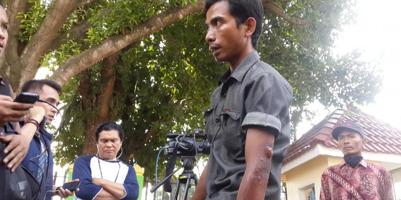 Cerita Rahmat yang Selamatkan Diri Saat Pesawat Hercules Jatuh di Medan