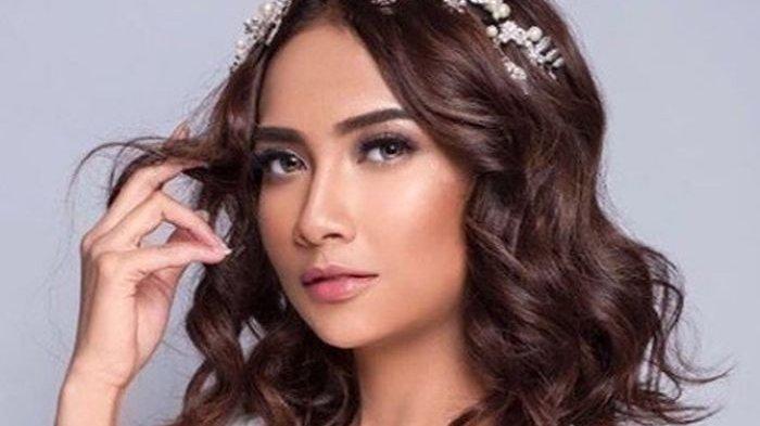 vanessa-angel-sudah-diperbolehkan-pulang_1.jpg