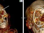 Berikut-Gambar-CT-scan-tengkorak-salah-satu-mumi-dari-Amerika-Selatan.jpg