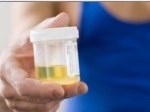 ilustrasi-urine-test.jpg