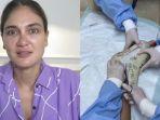luna-maya-lepas-gips-di-kakinya.jpg