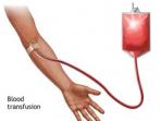 transfusi-darah_20160206_182741.jpg