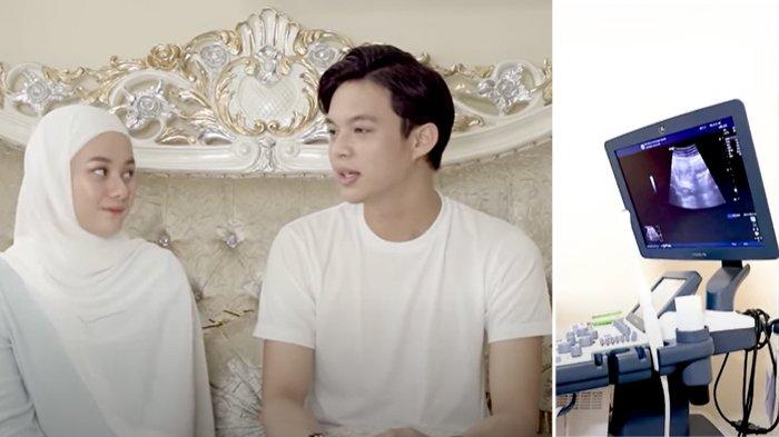 Dinda Hauw Umumkan Kehamilan, Rey Mbayang Rela Aduk-Aduk Tempat Sampah Demi Lihat Hasil Testpack