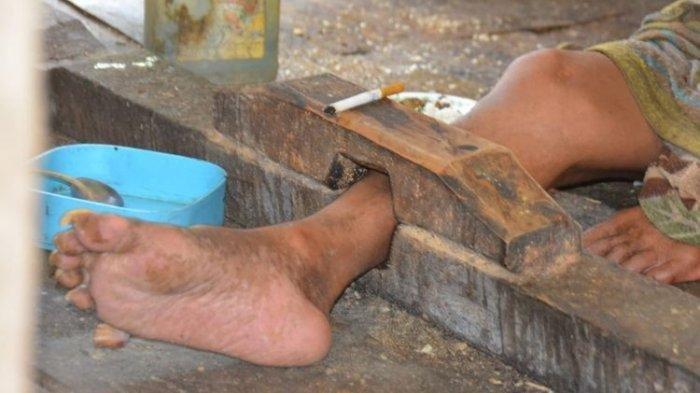 2.142 Warga Kabupaten Serang Alami Gangguan Jiwa, 4 Di Antaranya Hidup dalam Pasungan pada 2022