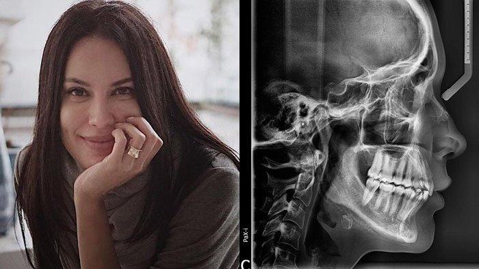 Foto Rontgen Tengkorak Sophia Latjuba Bikin Geger, Cantik Luar Dalam karena Skin Care Meresap Sumsum