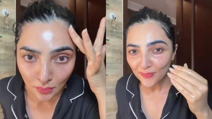 Dikomentari Pipinya Kempot, Ashanty Beberkan Kondisi Wajah: Aku Nggak Seberuntung yang Sempurna