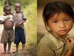 Ilustrasi-Gizi-Buruk-dan-Stunting.jpg