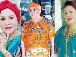 Mpok-Atiek-artis-dan-komedian-senior-yang-dulu-ketagihan-suntik-silikon.jpg