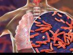 foto-ilustrasi-penyakit-tuberculosis-tbc.jpg