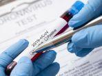 ilustrasi-keterangan-positifnegatif-virus-corona.jpg