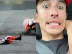 lengan-Marc-Marquez.jpg