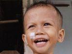 Muhammad-Dylan-Alfa-Rizqi-balita-Batang-penderita-jantung-bocor.jpg