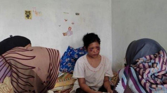 KISAH ART Asal Garut Disiksa Majikan, Awalnya Ketahuan Ngadu ke Orangtua