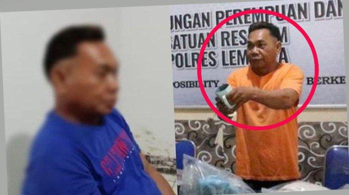 Karena Cinta Ditolak, Pria 49 Tahun Ini Siram Muka Siswi SMP 13 Tahun Ini dengan Air Keras