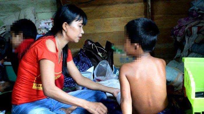 MAS yang Dipaksa Minum Air Kencing dan Dibakar, Sempat Berteriak Minta Tolong. Ini Kornologisnya